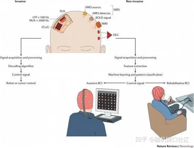 超声波脑机接口，能够用思维控制电脑